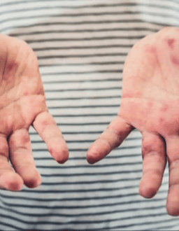 Top Infectious Disease Doctors near me