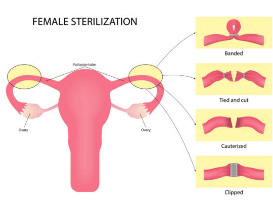 MTP Specialist in Pune