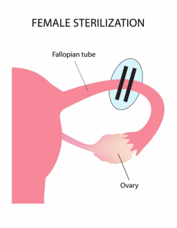mtp specialist near me