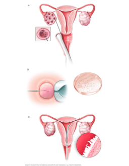 infertility dr near me